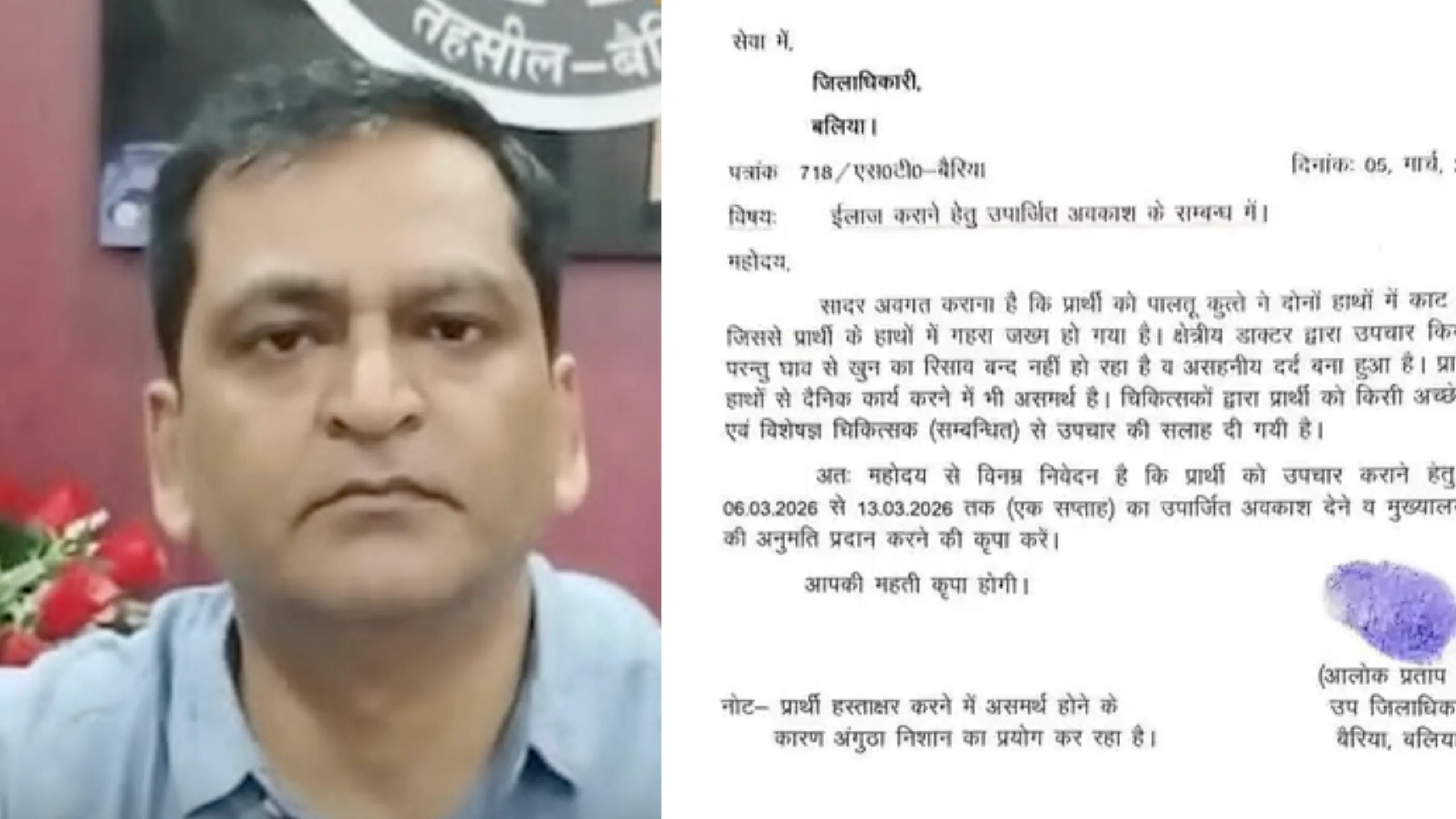 SDM requests DM for Medical Leave after bitten by Dog