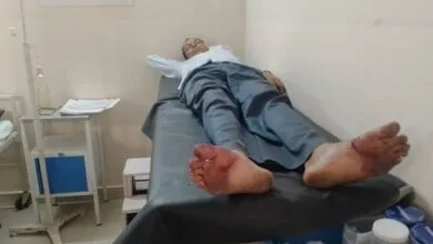 SBI Bank Accident: Guard’s Gun Fires After Falling, Elderly Man Injured