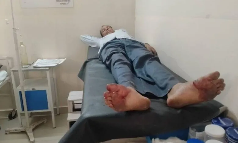 SBI Bank Accident: Guard’s Gun Fires After Falling, Elderly Man Injured