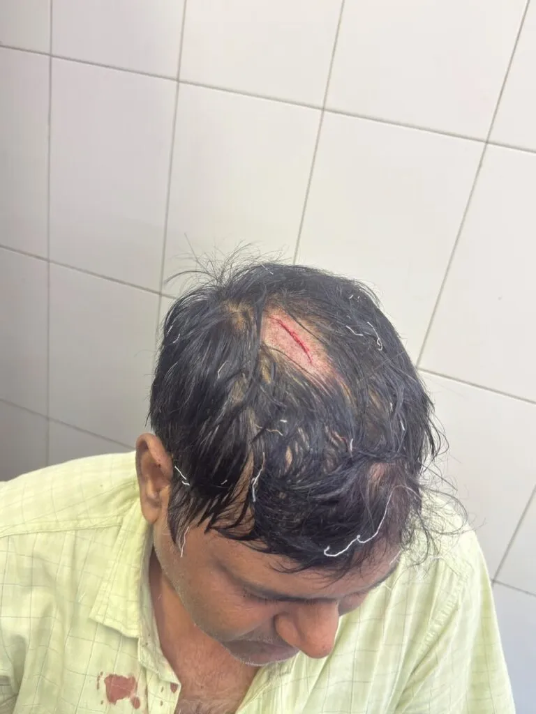 Fatal Attack on Indian Bank Manager in Delhi