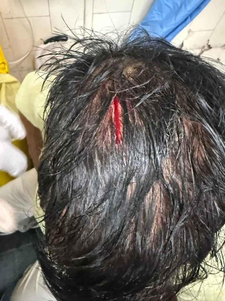 Fatal Attack on Indian Bank Manager in Delhi
