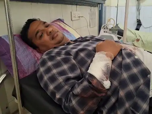Injured Bank of Baroda Staff