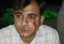 HDFC Bank manager brutally assaulted in Pratapgarh Uttar Pradesh