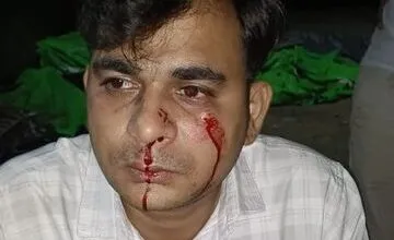 HDFC Bank manager brutally assaulted in Pratapgarh Uttar Pradesh