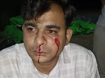 HDFC Bank manager brutally assaulted in Pratapgarh Uttar Pradesh
